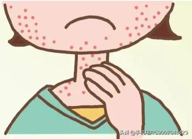 过敏性皮肤炎儿童:孩子过敏性皮炎要注意什么？