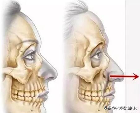 抬头纹重怎么办(天生抬头纹就很严重怎么去除)