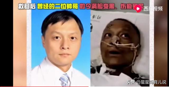 武汉中心医院，两位医生为什么变成“黑人”？