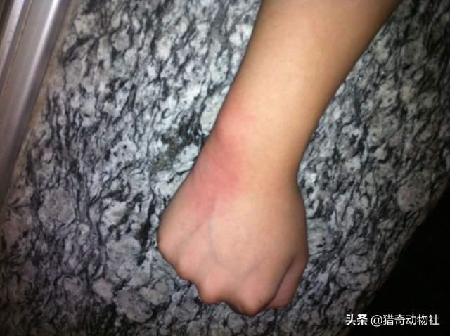 华丽巨蚊会捕食蚊子吗:只有母蚊子才会叮人吸血吗？