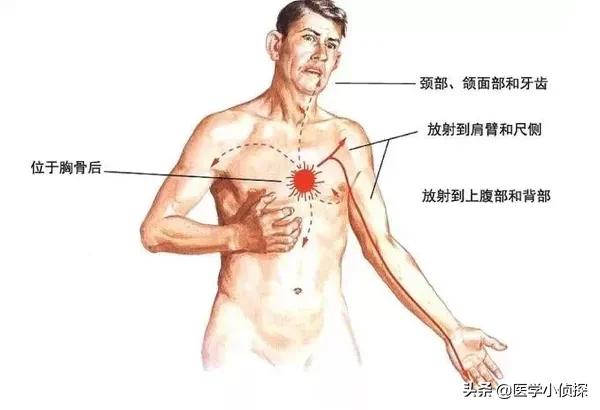 先天性心脏病的症状:先天性心脏病的症状有哪些呢 小儿先天性心脏病平时有什么反应？