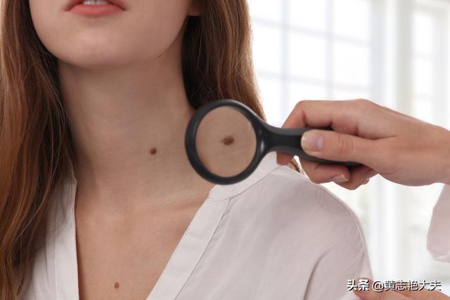 肝脏开始病变,会在身上长哪2种痣？在身体哪个部位？