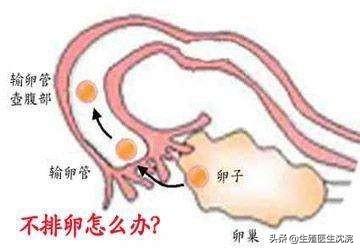 无排卵怎么办(无排卵怎么治疗方法)