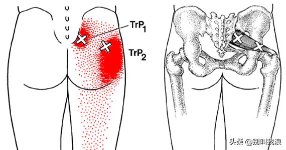 头条问答 - 坐久了屁股痛,怎么回事?(5个回答)