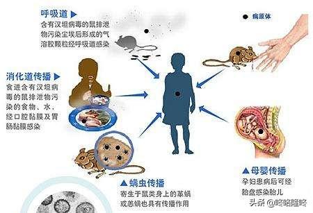 黑线鼠药物:汉坦病毒传染不，有没有官方的通报出来？该怎么办？