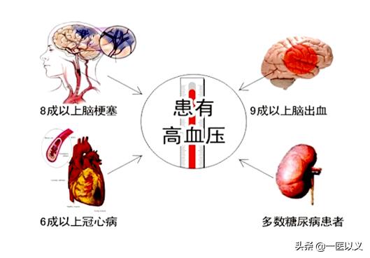 腔梗是什么意思,腔隙性脑梗塞到底是什么？