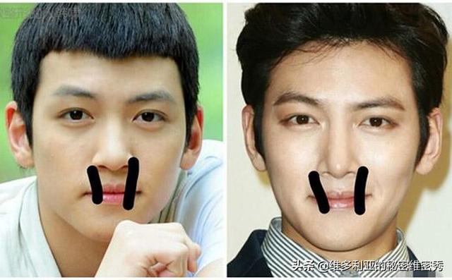 李民浩整容前后:有哪些男明星公开承认过整形？