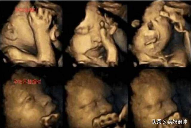 如何预防胚胎停育？