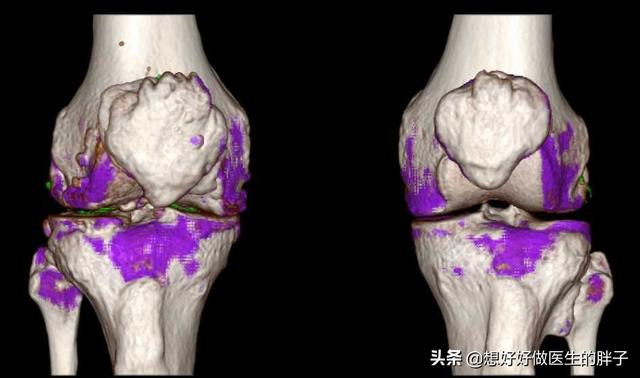 受寒邪侵袭该怎么办，孩子昨天洗澡好像感冒了，有什么药可以让孩子马上好起来？