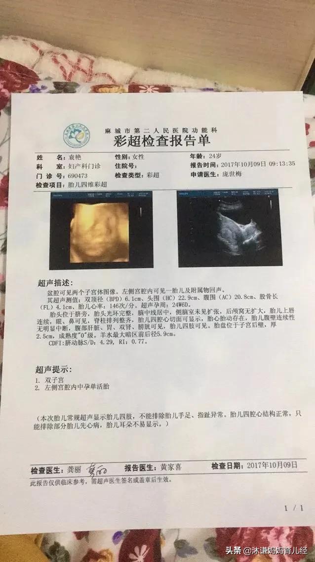 头条问答 双子宫能生育吗 55个回答