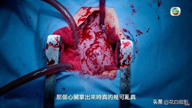 唐诗咏男友:手术道具过于真实，TVB高分港剧《白色强人》到底是怎样炼成的