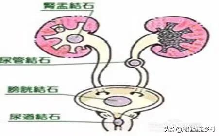 膀胱结石症状预防:﻿冬季快到了，如何预防羊尿结石？