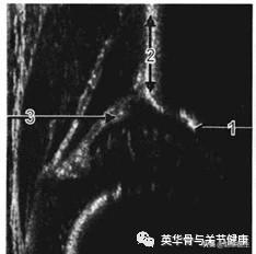 胯关节发育不良:狗狗髋关节发育不良怎么办？