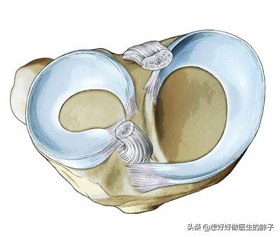 半月板损伤症状:半月板损伤症状有哪些 膝盖半月板损伤还能治好吗？