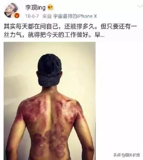 非常静距离李现:如果你是明星，你会选择爆红还是慢慢被观众熟知