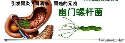 感染幽门螺旋杆菌,吃什么能杀菌养胃？