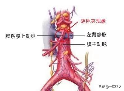 急性腹膜炎腹痛的特点:急性肠胃炎腹痛一阵一阵的是为何 腹部疼痛又呕吐，这是什么情况？