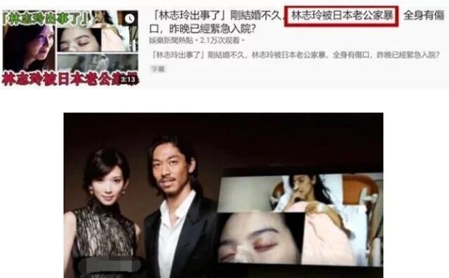 徐佳莹否认怀孕:林志玲被曝患有子宫癌无法生育，是真的吗？