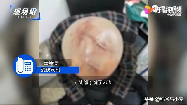 男子被牧羊犬袭击缝80针:哈尔滨一公交司机遭乘客水杯暴打头缝20针，你怎么看？