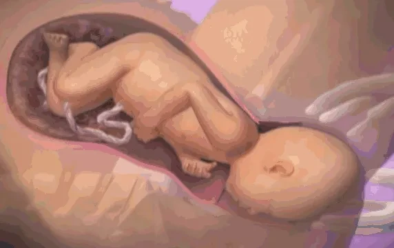 无痛分娩针的利与弊，初产孕妇选择无痛分娩还是无痛导乐？