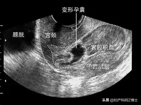 什么情况会子宫颈受孕？  第1张