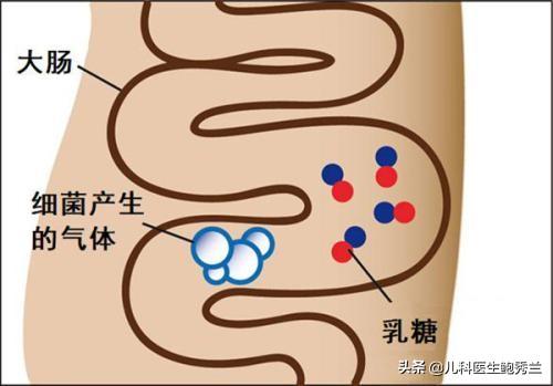 婴儿母乳乳糖不耐受的症状表现:乳糖不耐受会造成宝宝发育不良吗？该怎么办？