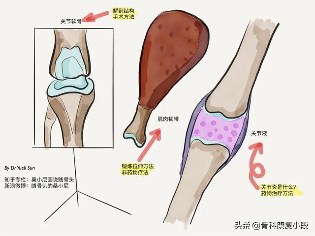 头条问答 双膝关节软骨磨损 现在有疼痛感 我要如何康复 如何训练 64个回答