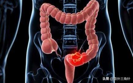 肠镜多长时间做一次好，间隔半个月再做一次肠镜对肠道有影响吗