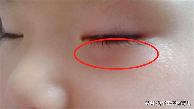 头条问答 - 孩子身体哪3处"变色",体现孩子积食,脾胃不好了?(1个回答)