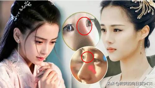 人鼻腔结构图:鼻子透光能证明是整容的吗？