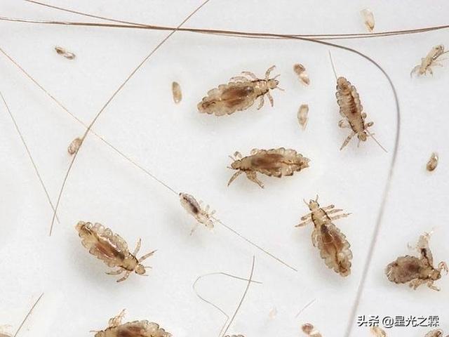 寄生虫感染的免疫:寄生虫感染的免疫特点主要表现为 狗狗驱虫和打疫苗有先后顺序么？