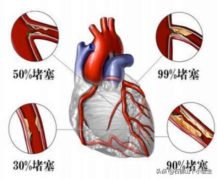 冠心脏病的症状有哪些:冠心病和其他心脏病的症状有什么不同？