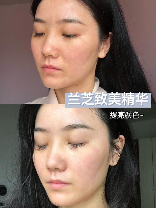 怎么改善肤色暗沉,肤色暗沉什么产品提亮效果好？
