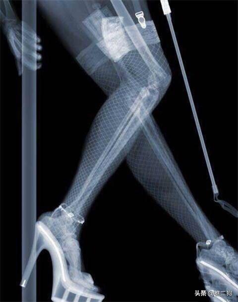 你们见过最美的腿长什么样别给我看我看到就反胃真的