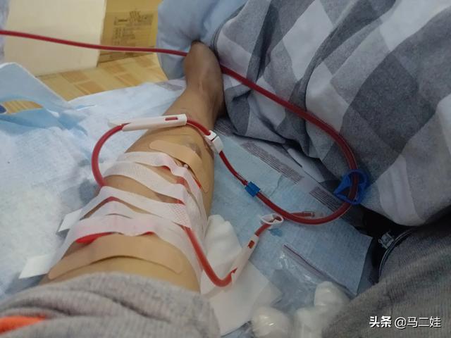 尿毒症病人越来越多,请问目前你们身边的透析病人都透析了多久呢?