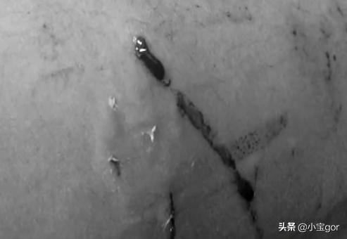 小孩狂犬病的早期症状:小孩被家猫咬到手需要打疫苗吗？ 小孩狂犬病的早期症状有哪些