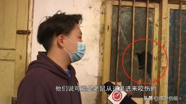 不明生物图片吓人，女婴睡觉时头皮被啃漏出头骨，原因是什么呢？