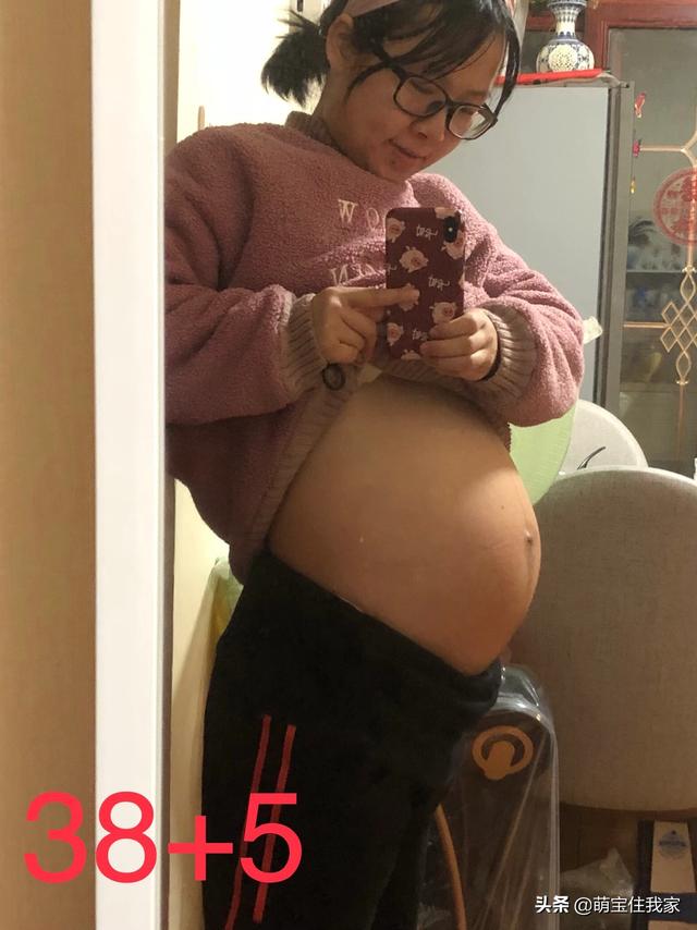 怀孕多久会长妊娠纹？为什么会长妊娠纹？插图18