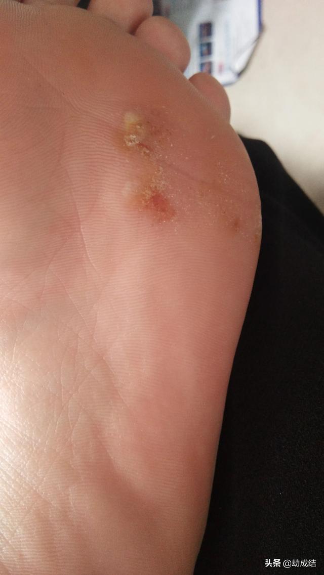 哪一瞬间突然觉得自己很心酸？