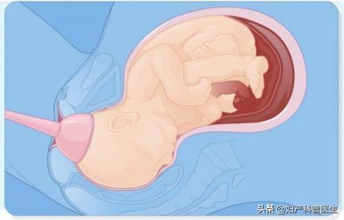 男子活剖孕狗拍视频无删减:死后分娩是怎样一种现象，婴儿还能存活吗？