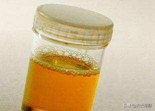 虫不知国语:爆笑虫子里的小黄和小红分别是什么生物？