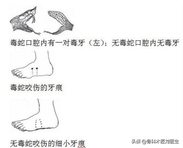 黄哥哥vlog的回答-头条问答
