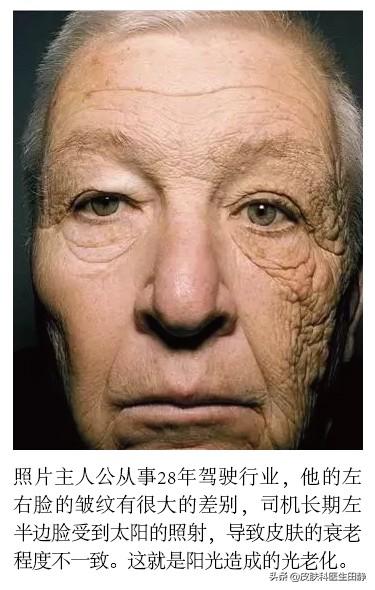 头条问答 - 为了抵御皮肤光老化,在室内人工照明环境下有必要擦防晒霜