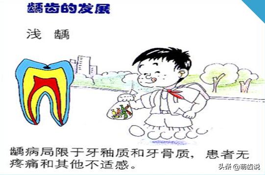 儿童补牙(儿童补牙一般多少钱一颗)