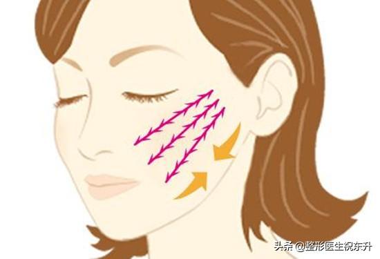 女生脸部护理小知识:女生脸上法令纹是什么？又该如何护肤抚平法令纹呢？