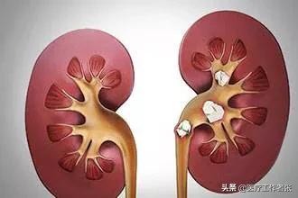 豹龟结石:为什么结石排完过几年又有？