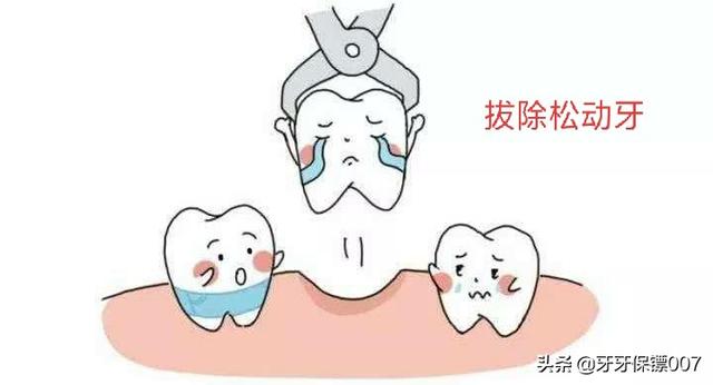 牙弓夹板牵引带久了牙齿酸:矫正牙齿后牙齿会不会变得脆弱？