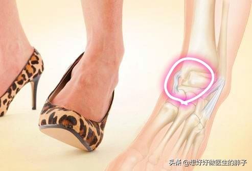 膝盖软骨磨损和风湿什么区别:不跑步的人膝关节也磨损、坏死，该怎么解释呢？