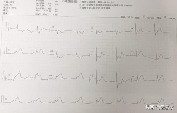 诺里奇梗优缺点:柯基和雪纳瑞，哪个更好？ 诺福克梗和诺里奇梗