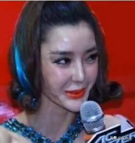 侣皓喆:娱乐圈有哪些整容失败的案例？
